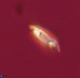Tenebrolamina gibbsiae VR 33075