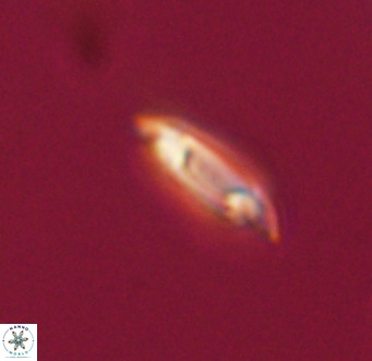 Tenebrolamina gibbsiae VR 33075