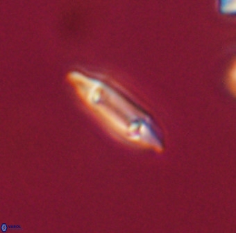 Tenebrolamina gibbsiae VR 33079