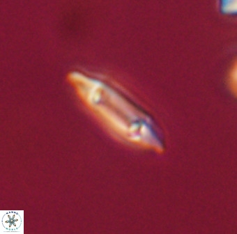 Tenebrolamina gibbsiae VR 33079