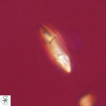 Tenebrolamina gibbsiae VR 33070