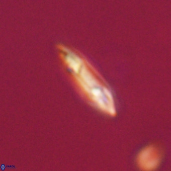 Tenebrolamina gibbsiae VR 33071