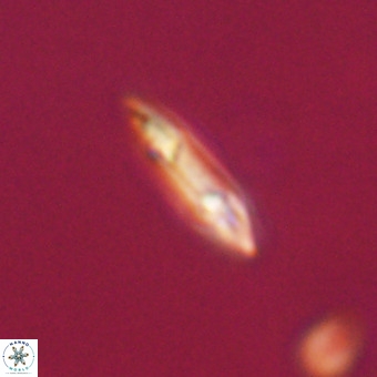 Tenebrolamina gibbsiae VR 33071