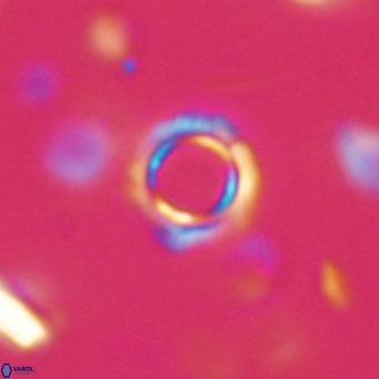 Tenebrolamina protoannulus VR 29871