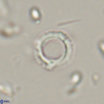 Tenebrolamina protoannulus VR 29872