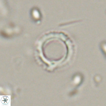 Tenebrolamina protoannulus VR 29872