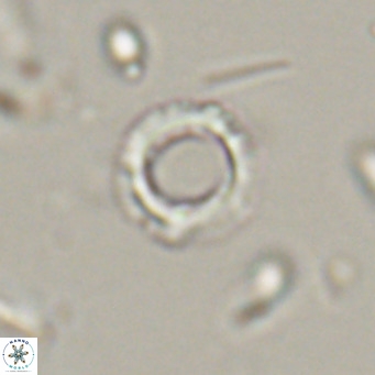 Tenebrolamina protoannulus VR 29873