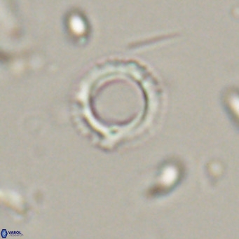 Tenebrolamina protoannulus VR 29874