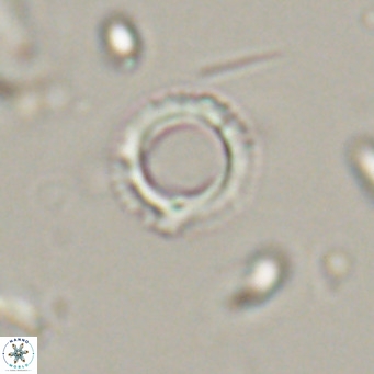 Tenebrolamina protoannulus VR 29874