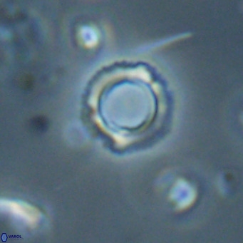 Tenebrolamina protoannulus VR 29875