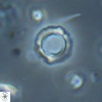 Tenebrolamina protoannulus VR 29875