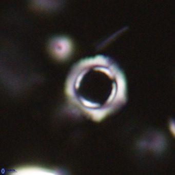 Tenebrolamina protoannulus VR 29876