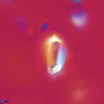 Tenebrolamina protoannulus VR 29878