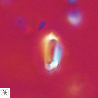Tenebrolamina protoannulus VR 29878