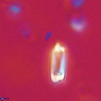 Tenebrolamina protoannulus VR 29880