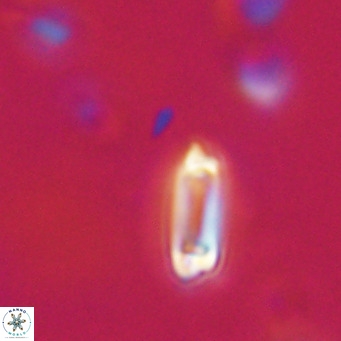 Tenebrolamina protoannulus VR 29880