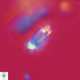 Tenebrolamina protoannulus VR 29887