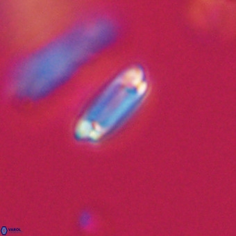 Tenebrolamina protoannulus VR 29888