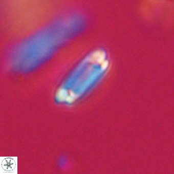 Tenebrolamina protoannulus VR 29888