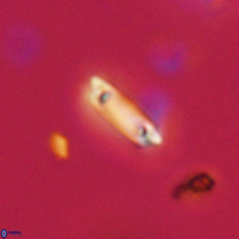 Tenebrolamina protoannulus VR 29898