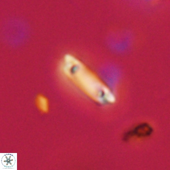 Tenebrolamina protoannulus VR 29898