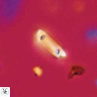 Tenebrolamina protoannulus VR 29911