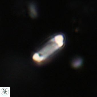 Tenebrolamina protoannulus VR 29913