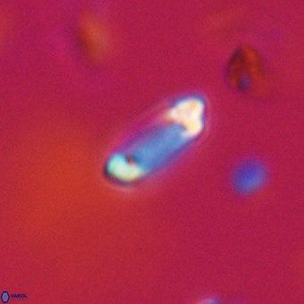 Tenebrolamina protoannulus VR 29915