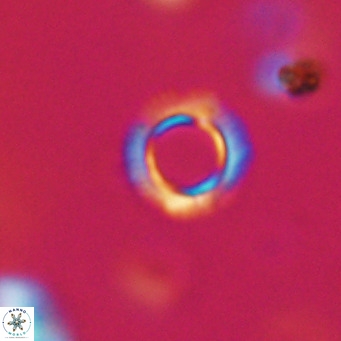 Tenebrolamina protoannulus VR 29920
