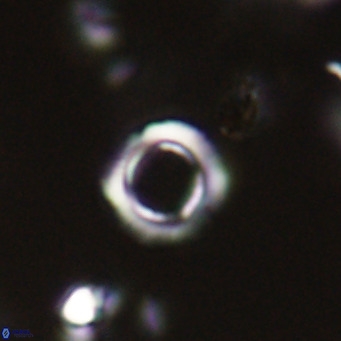 Tenebrolamina protoannulus VR 29928