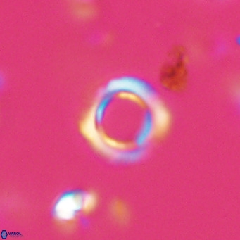 Tenebrolamina protoannulus VR 29930