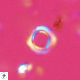 Tenebrolamina protoannulus VR 29930