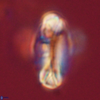 Tonromeinia davidii 52627