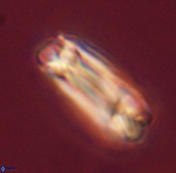 Tonromeinia deniseae 45798