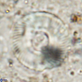 Tonromeinia deniseae 49879