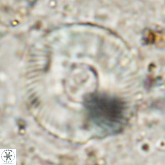 Tonromeinia deniseae 49879
