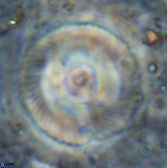 Tonromeinia deniseae 49880