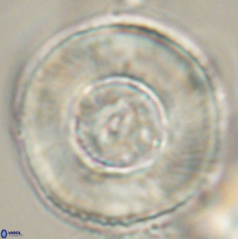 Tonromeinia deniseae 52652