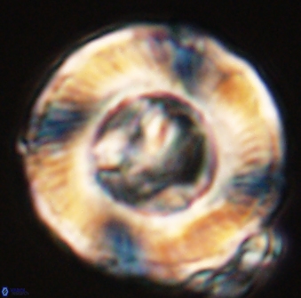 Tonromeinia deniseae 55581