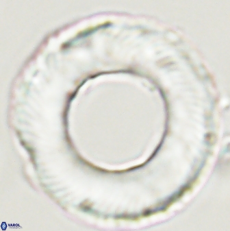 Tonromeinia deniseae 55725