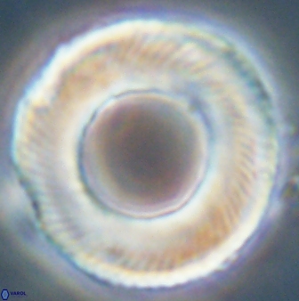 Tonromeinia deniseae 55726