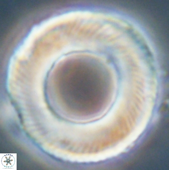 Tonromeinia deniseae 55726