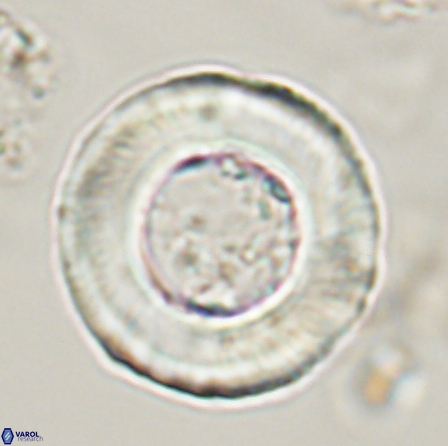 Tonromeinia deniseae 56240