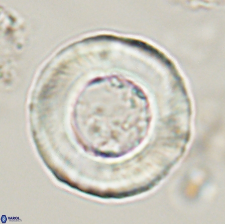 Tonromeinia deniseae 56241