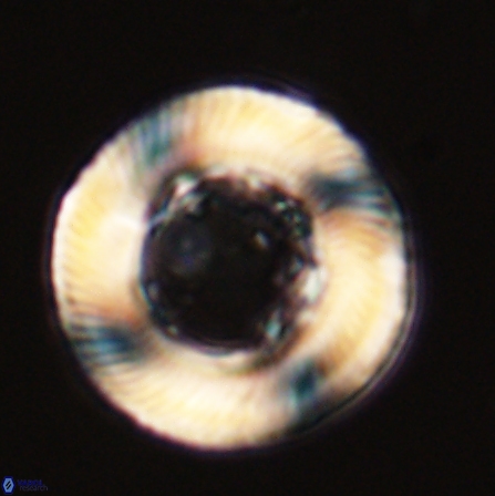 Tonromeinia deniseae 56246