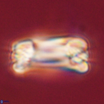 Tonromeinia deniseae 57042