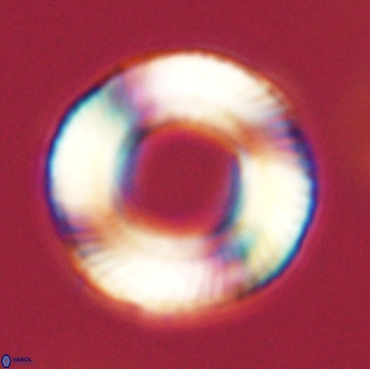 Tonromeinia deniseae 57056