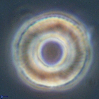 Tonromeinia deniseae 57065