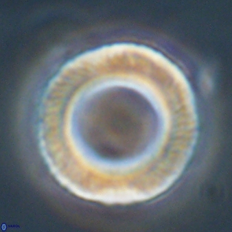 Tonromeinia deniseae 57066