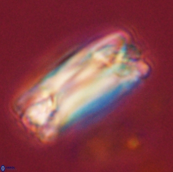 Tonromeinia deniseae 57027